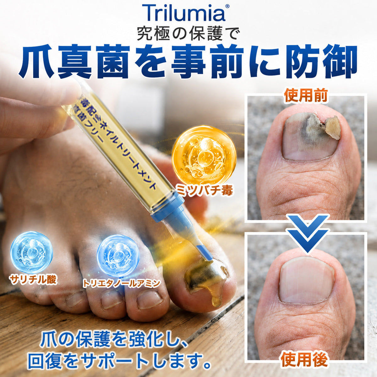 🇯🇵 Trilumia® Fungi Free ビーベノム ネイルトリートメント 👨‍⚕️ – わずか7日で目に見える変化を実感