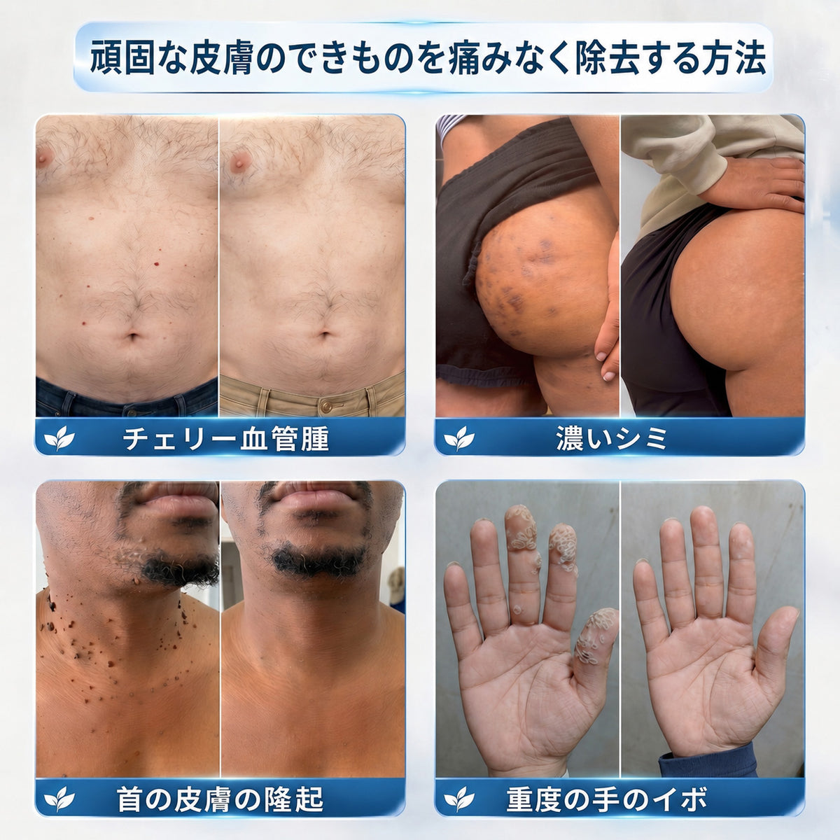 ✨ 70%OFF｜CUREVIVO® 公式ストア🛡️｜7日間 スキンタッグ・気になる黒ずみ集中ケアクリーム｜GMP認証工場製造・植物由来処方