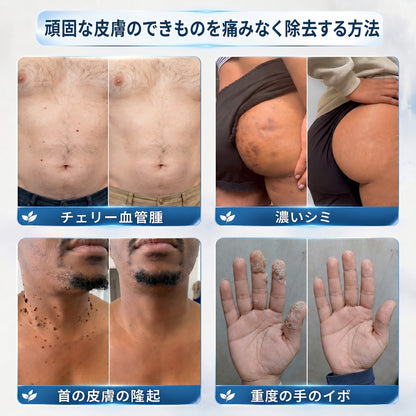 ✨ 70%OFF｜CUREVIVO® 公式ストア🛡️｜7日間 スキンタッグ・気になる黒ずみ集中ケアクリーム｜GMP認証工場製造・植物由来処方