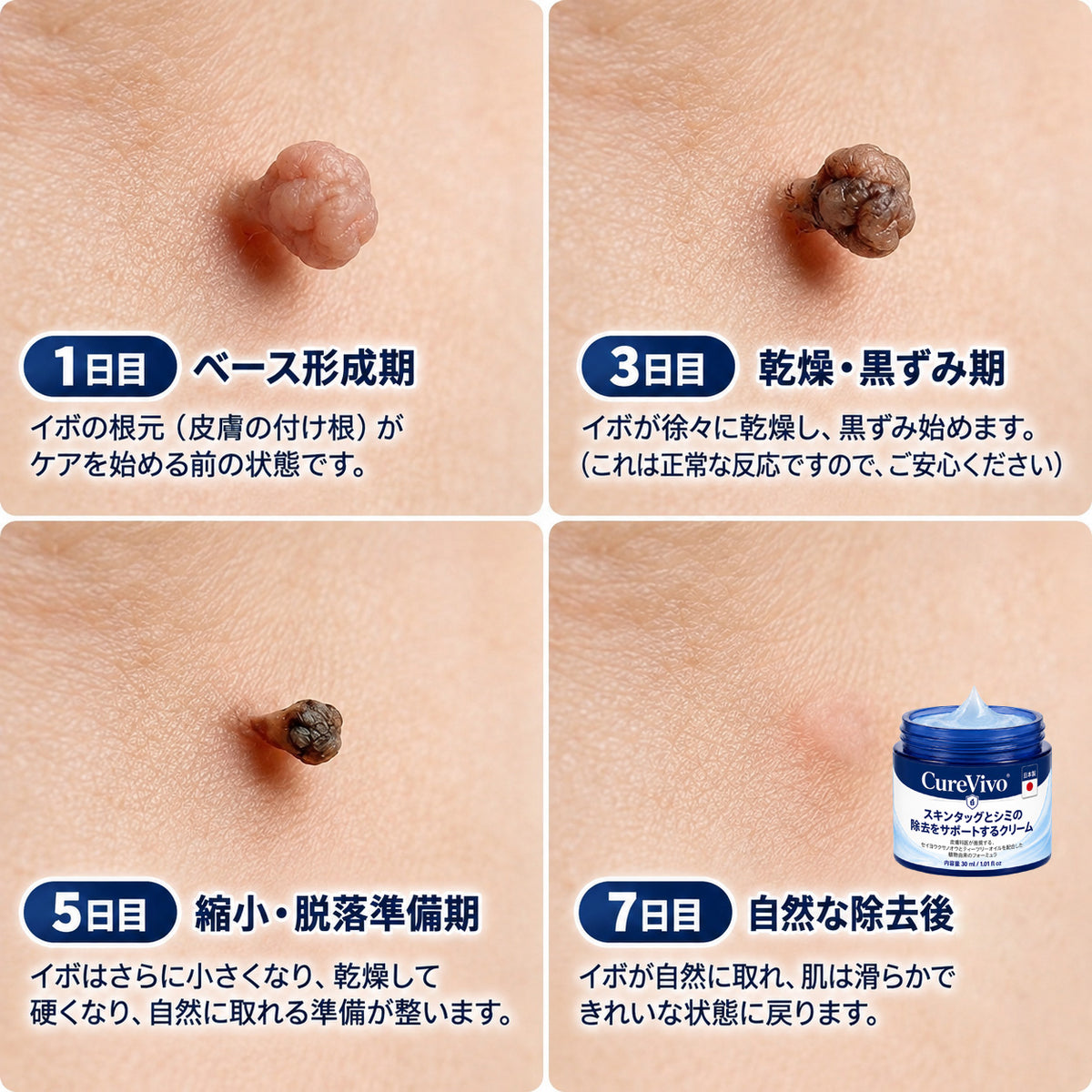 ✨ 70%OFF｜CUREVIVO® 公式ストア🛡️｜7日間 スキンタッグ・気になる黒ずみ集中ケアクリーム｜GMP認証工場製造・植物由来処方
