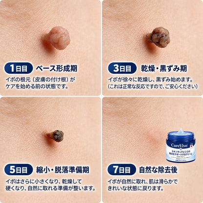✨ 70%OFF｜CUREVIVO® 公式ストア🛡️｜7日間 スキンタッグ・気になる黒ずみ集中ケアクリーム｜GMP認証工場製造・植物由来処方