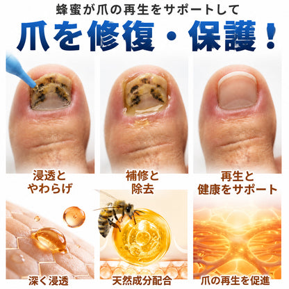 🇯🇵 Trilumia® Fungi Free ビーベノム ネイルトリートメント 👨‍⚕️ – わずか7日で目に見える変化を実感