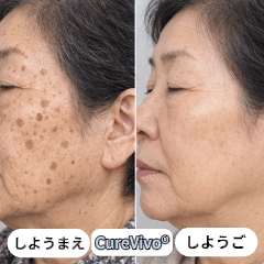 ✨ 70%OFF｜CUREVIVO® 公式ストア🛡️｜7日間 スキンタッグ・気になる黒ずみ集中ケアクリーム｜GMP認証工場製造・植物由来処方